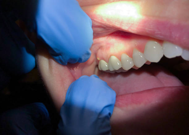 Best Urgent Dental Care for Toothache in Wolf Lake, MI
