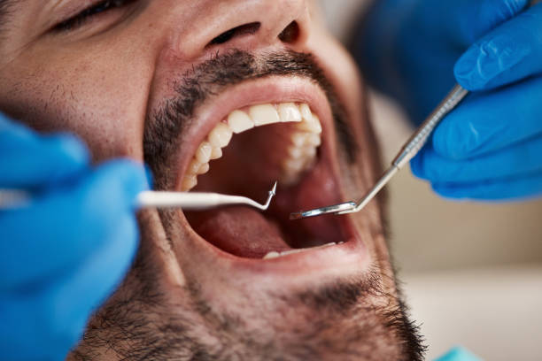 Best Holiday Emergency Dentist in Wolf Lake, MI