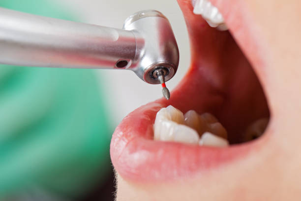 Best Pediatric Emergency Dentist in Wolf Lake, MI